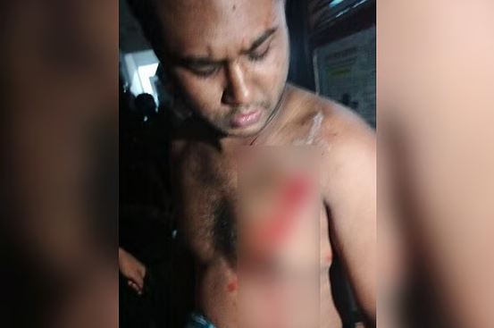 রুমমেটকে ছুরিকাঘাতের অভিযোগ, ডাকসুর ভিপি প্রার্থী জালাল হল থেকে বহিষ্কৃত
