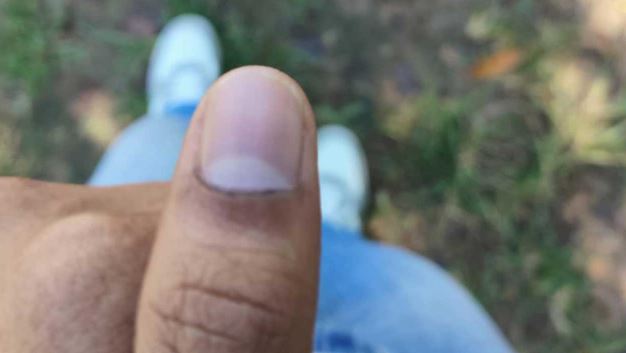 চাকসু নির্বাচন: মুছে যাচ্ছে কালি, অভিযোগ ছাত্রদলের জিএস প্রার্থীর