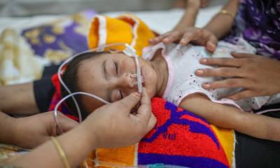 ২৪ ঘন্টায় হাম ও হামের উপসর্গে আরও ১০ শিশুর মৃত্যু, আক্রান্ত ৭৩২