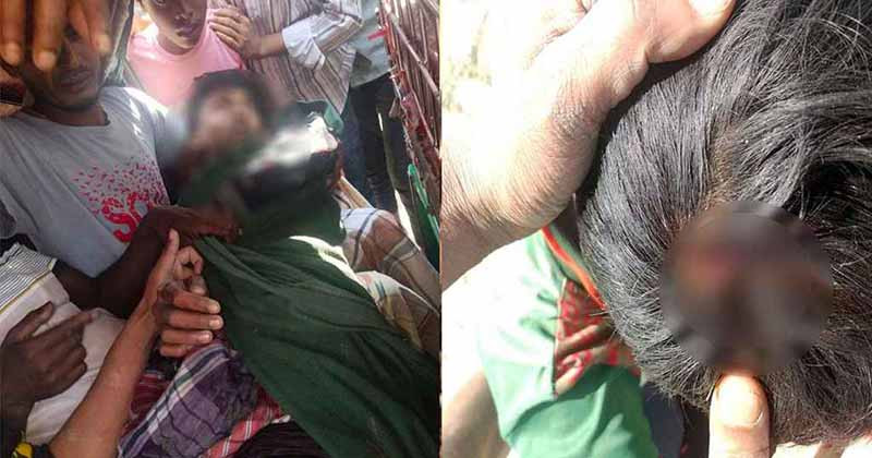 মিয়ানমার থেকে ছোড়া গুলিতে টেকনাফে দুই কিশোর আহত